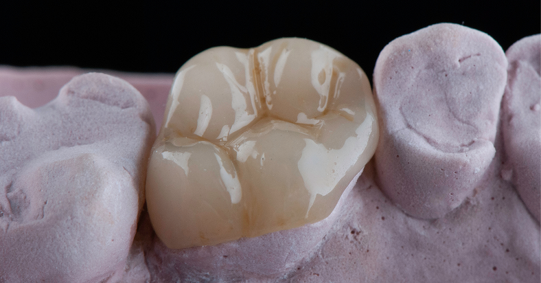 Diploma in Aesthetic & Restorative Dentistry (EduQual Level 7)​