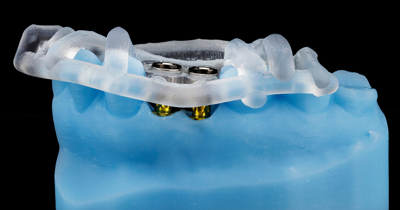 Diploma in Dental Implantology & Oral Surgery (EduQual Level 7)​