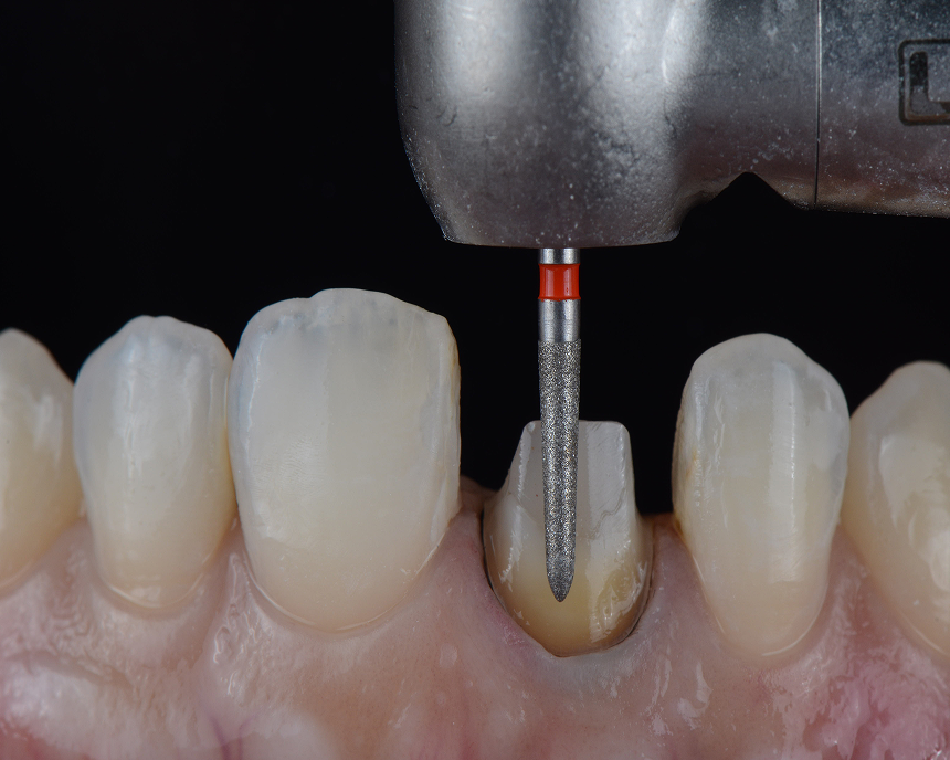 Diploma in Aesthetic & Restorative Dentistry