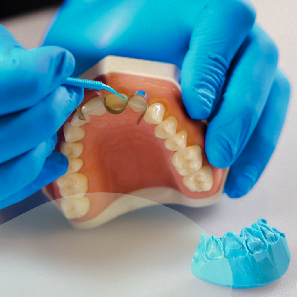 Dental procedure