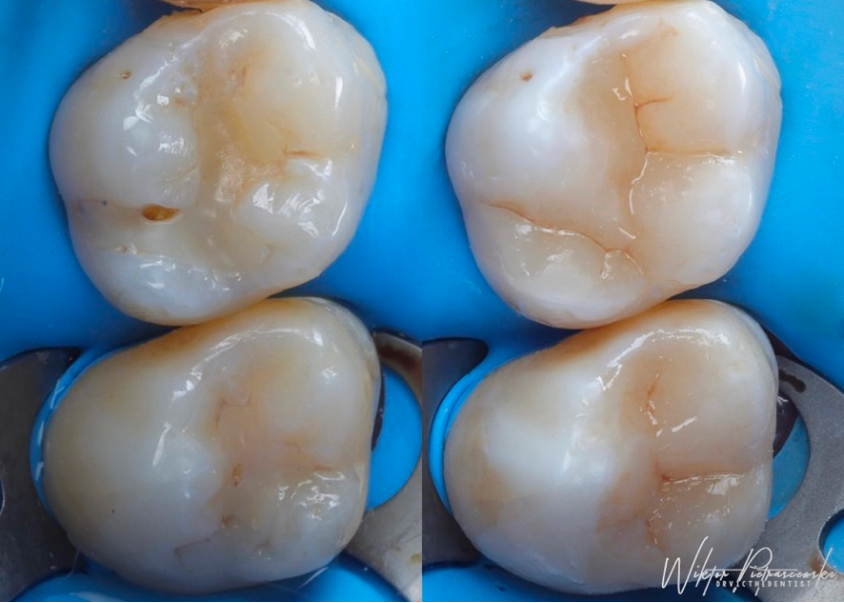 Cusp | London Dental Institute