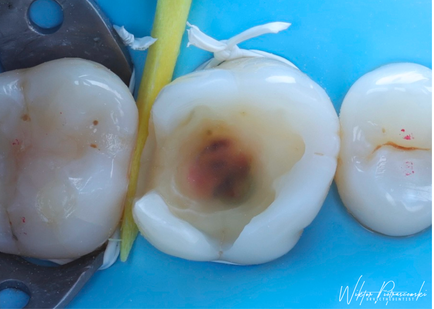 Cusp | London Dental Institute